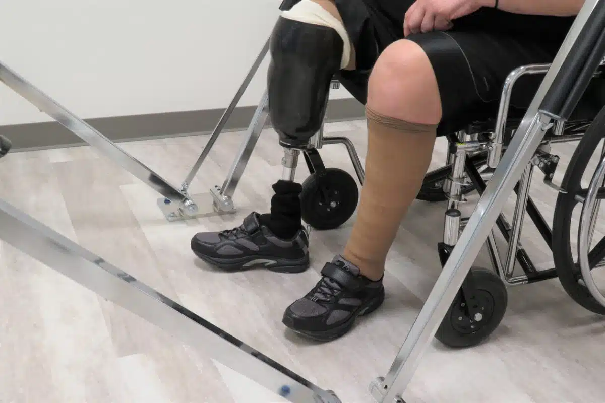 Optimiser sa rééducation focus sur l'amputation de la demi-jambe